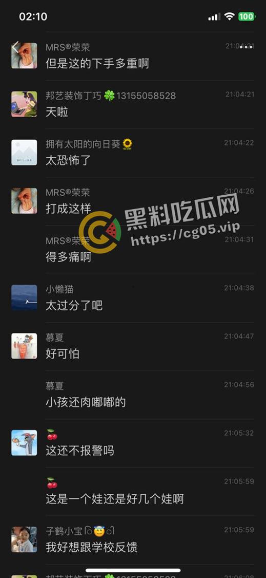 泰州外国语小学老师暴打小学生 全身淤青 家长群内声讨被解散 至今无说法 第8张 泰州外国语小学老师暴打小学生 全身淤青 家长群内声讨被解散 至今无说法 第8张