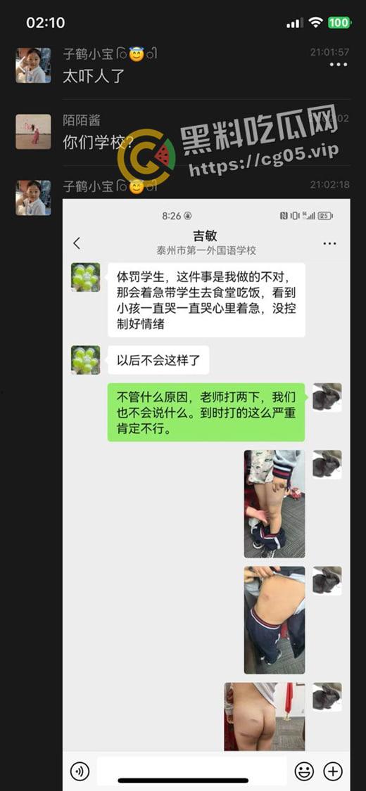 泰州外国语小学老师暴打小学生 全身淤青 家长群内声讨被解散 至今无说法 第11张 泰州外国语小学老师暴打小学生 全身淤青 家长群内声讨被解散 至今无说法 第11张