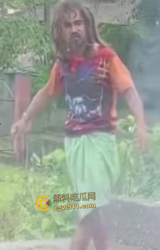 英国穷鬼流浪汉狠炸自己!老婆跑路绝望拿鞭炮塞嘴自爆折磨,威力太小没死成却逗乐路人狂笑! 第4张 英国穷鬼流浪汉狠炸自己!老婆跑路绝望拿鞭炮塞嘴自爆折磨,威力太小没死成却逗乐路人狂笑! 第4张