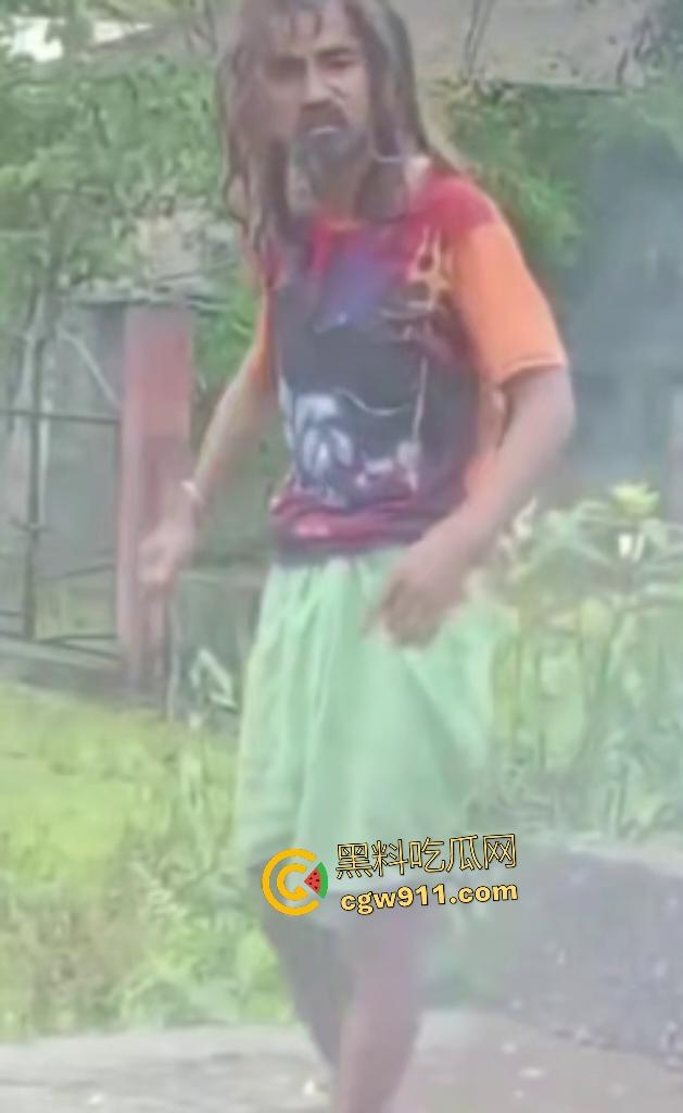 英国穷鬼流浪汉狠炸自己!老婆跑路绝望拿鞭炮塞嘴自爆折磨,威力太小没死成却逗乐路人狂笑! 第6张 英国穷鬼流浪汉狠炸自己!老婆跑路绝望拿鞭炮塞嘴自爆折磨,威力太小没死成却逗乐路人狂笑! 第6张