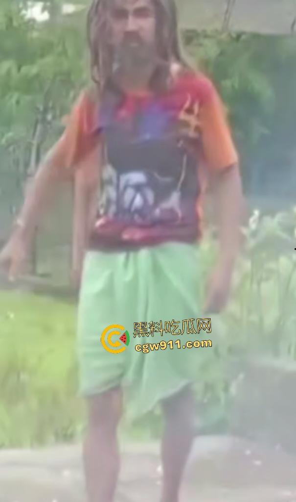 英国穷鬼流浪汉狠炸自己!老婆跑路绝望拿鞭炮塞嘴自爆折磨,威力太小没死成却逗乐路人狂笑! 第7张 英国穷鬼流浪汉狠炸自己!老婆跑路绝望拿鞭炮塞嘴自爆折磨,威力太小没死成却逗乐路人狂笑! 第7张