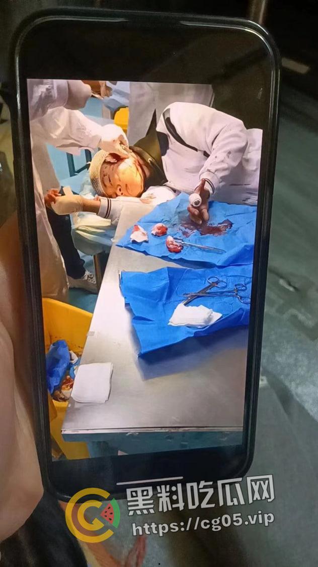 潮汕彩塘宏安中学学生砍人 女学生当场把同学耳朵砍掉 吓得学校学生第二天不敢来上学  第4张