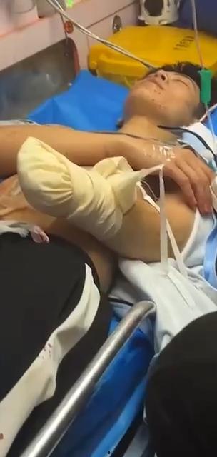 5月23号 厦门华天涉外职业技术学院 直播主 直播中遭刀仔持刀猛砍  左手掌被砍断 现场十分惊悚 第6张