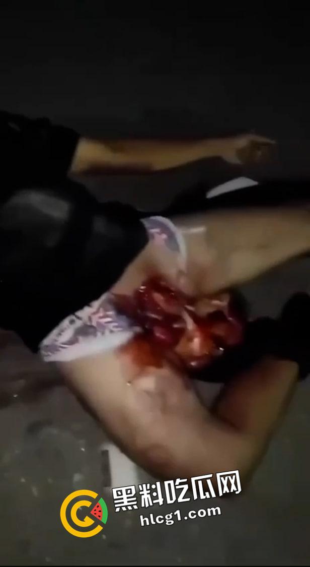 留学生圈又炸了！61当天加利福尼亚留学生男女车祸被腰斩 父母不愿收尸 现场血腥视频流出 这也太惨了  第7张