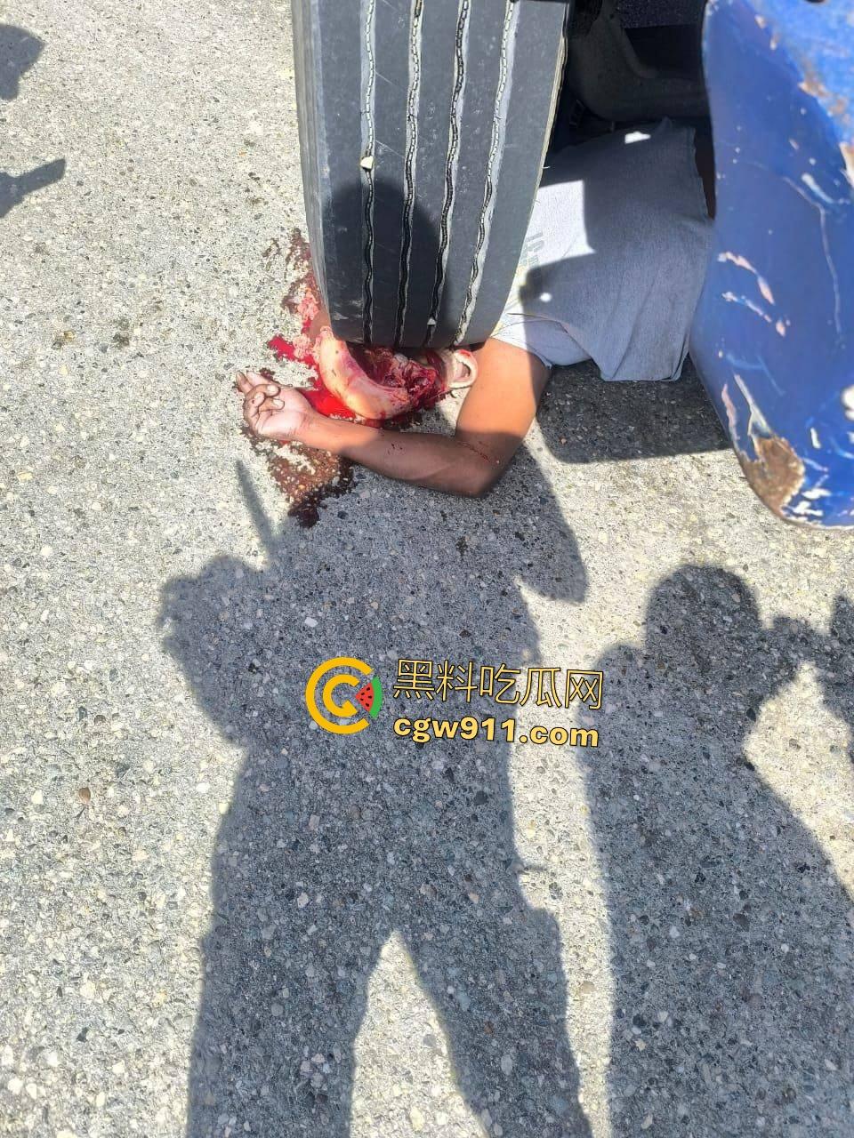 印尼摩托狂飙遭碾压！脑袋头皮刮飞露白骨，摩托吱吱狂响，车祸现场震碎人心，这还能救活吗？  第1张