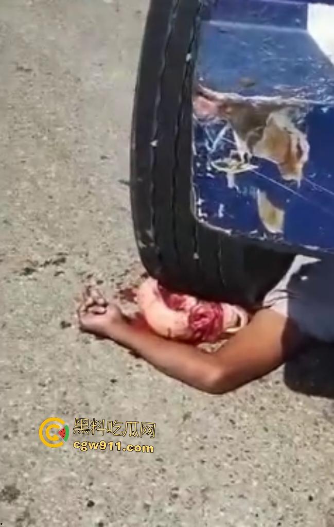 印尼摩托狂飙遭碾压！脑袋头皮刮飞露白骨，摩托吱吱狂响，车祸现场震碎人心，这还能救活吗？  第3张