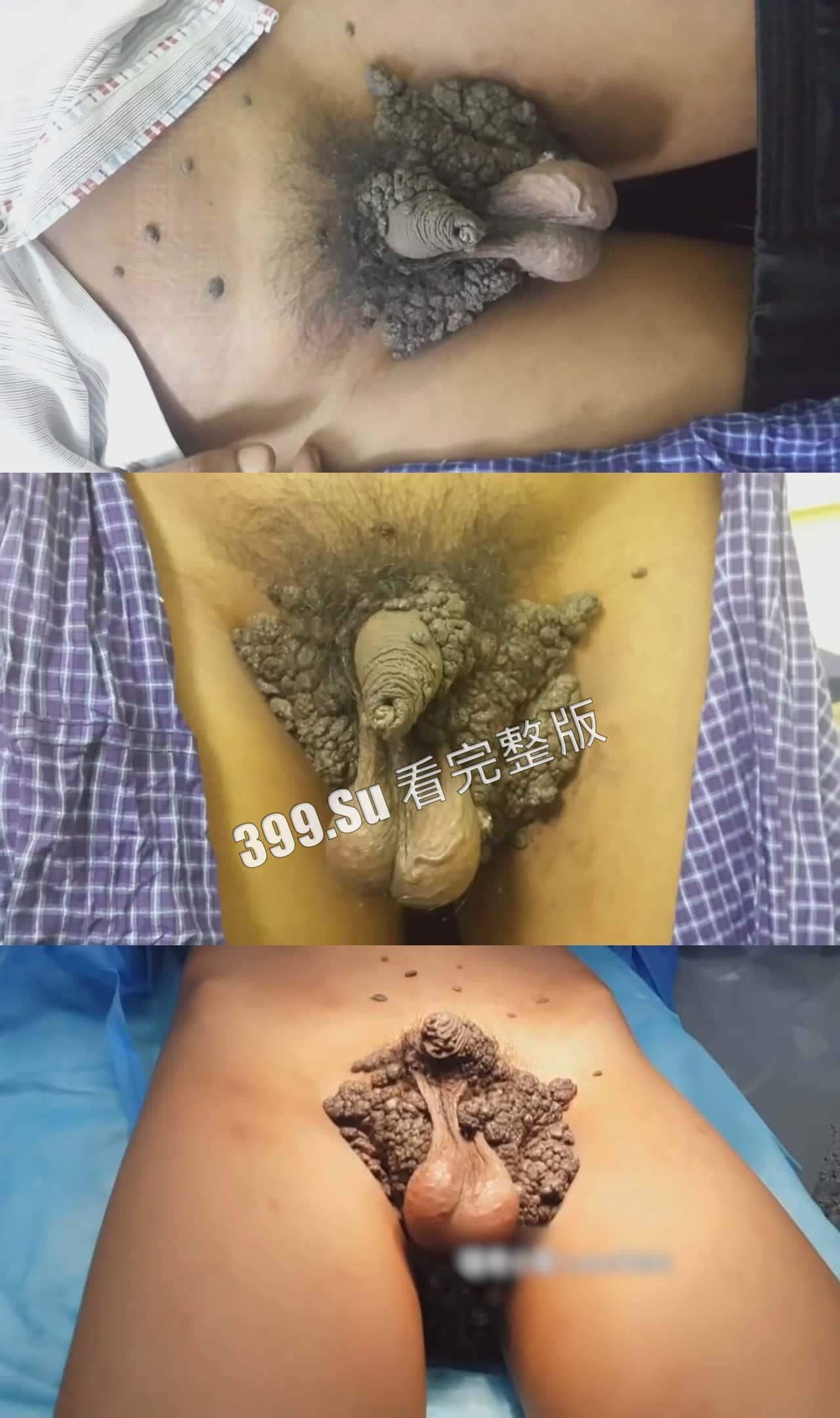 性病篇  谨慎观看！瓜友们出门在外 一定得洁身自爱 世界上没有后悔药 安全第一！！！ 第2张