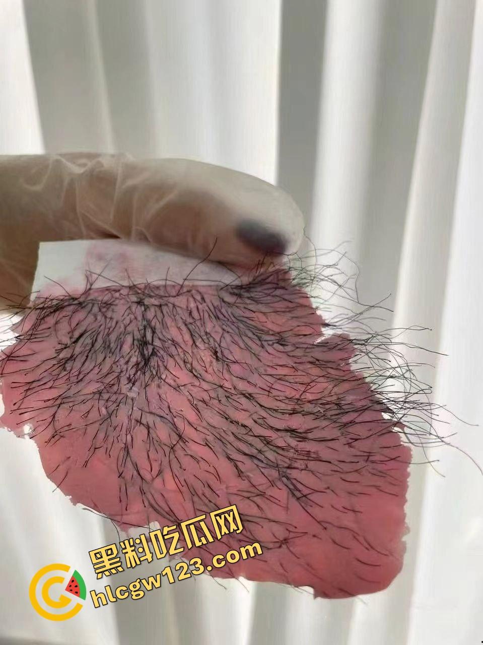 白虎不是天生的，是拔出来的，人工白虎养骗局曝光逼毛一根根扯，看得人蛋蛋一紧！  第11张