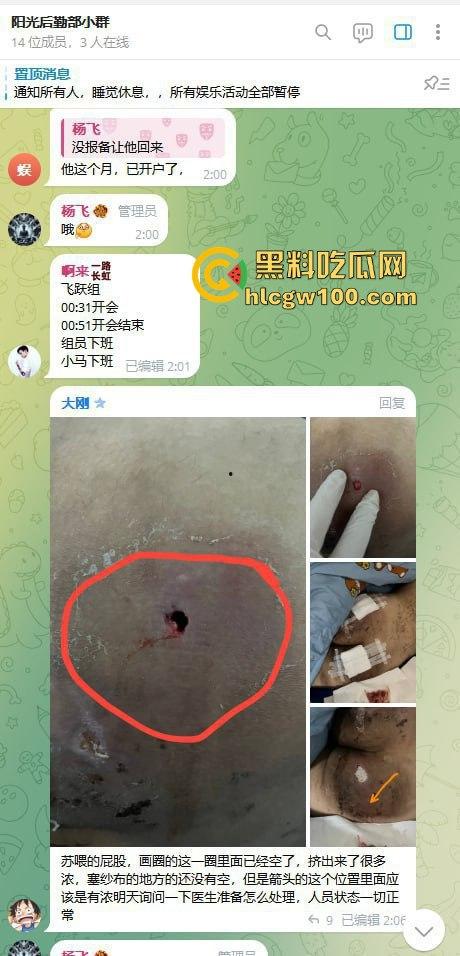 东南亚黑园区阳光集团暴力惊现，妙瓦底七号山庄每日暴打员工，没业绩直接打到人废，残忍画面慎点！  第4张