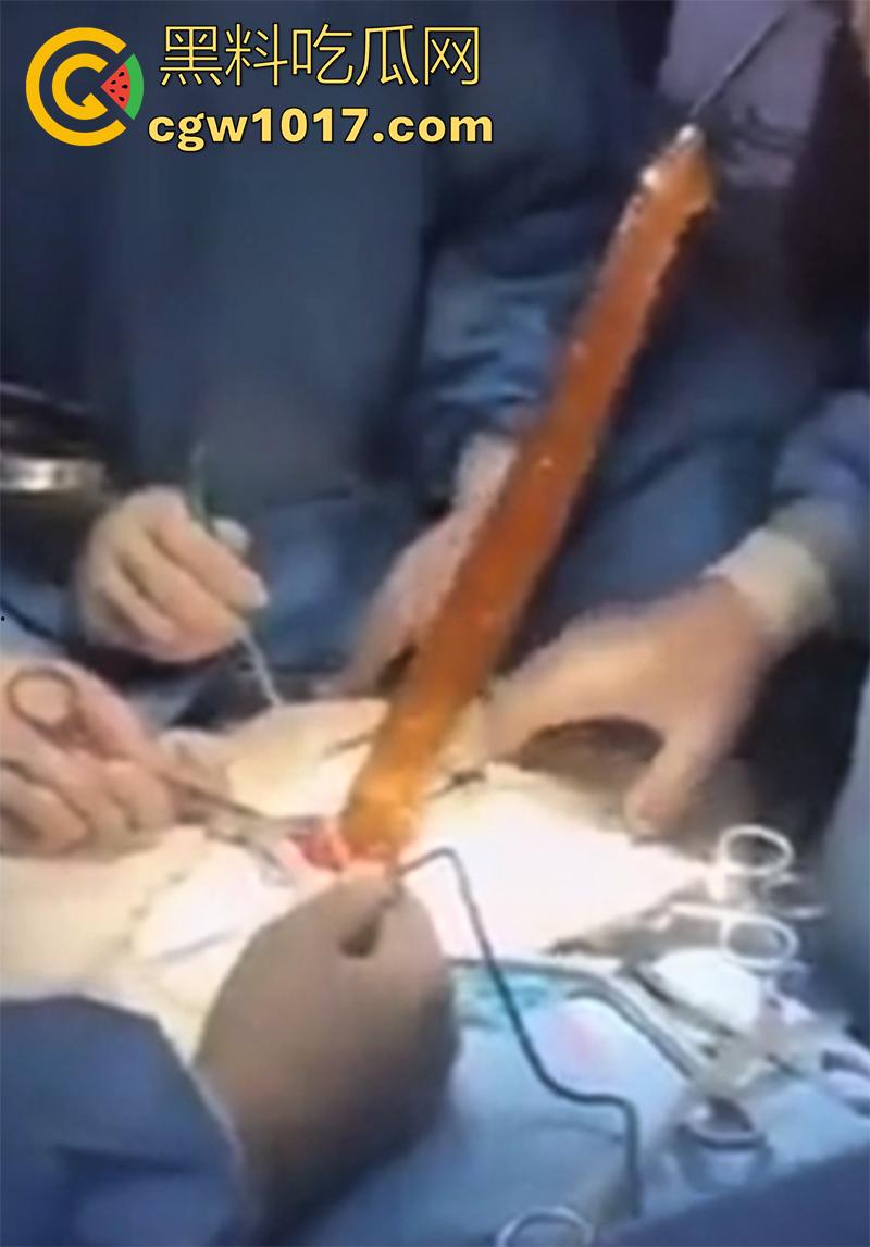 吉林大学三院副院长【刘俊志】，跟杨护士长玩SM，因嗑药嗑多直接玩脱了，护士长竟然被玩挂了！  第10张