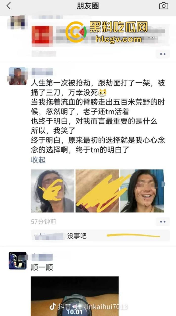 旅游博主在伊朗遭遇持刀抢劫 身中数刀死里逃生 为流量也是不要命了  第9张