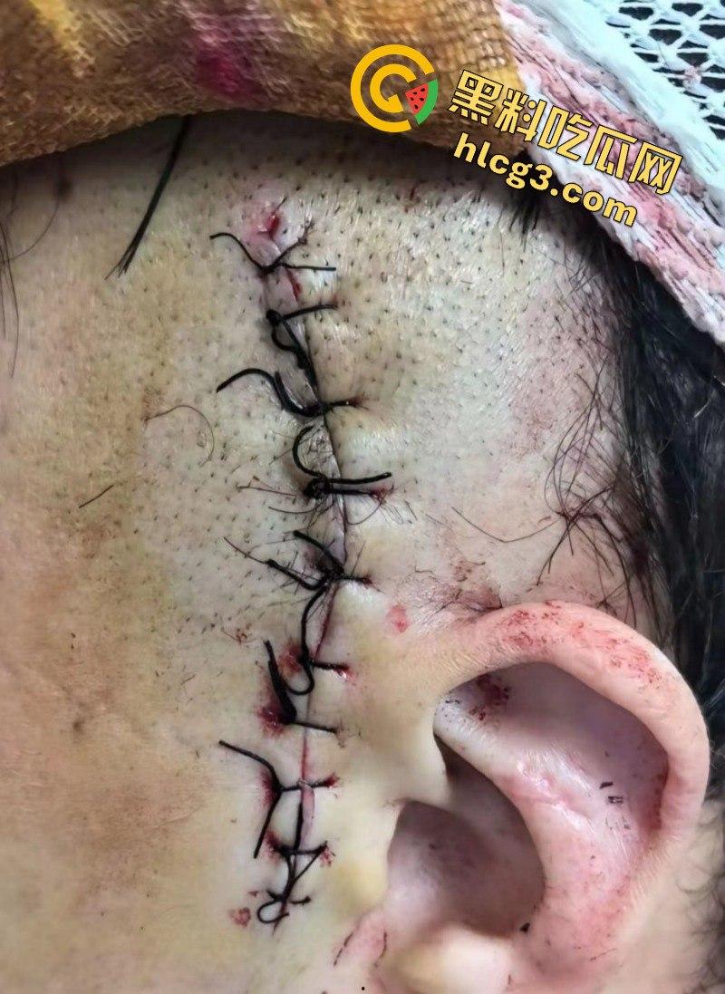 钱难赚屎难吃！广州大姐叫了个男模 不给小费反而还要男模给酒钱 不给直接给男模爆头  第7张