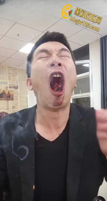 抖音狠人博流量 , 鞭炮嘴炸出血，脑残操作震惊全网 ！  第4张