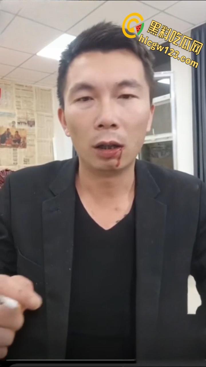 抖音狠人博流量 , 鞭炮嘴炸出血，脑残操作震惊全网 ！  第6张