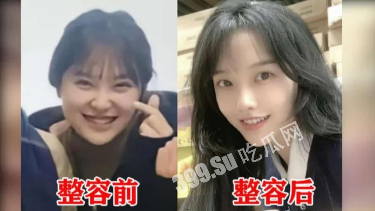 「挖呀挖老师」甜美笑眼全靠滤镜？ 前同事爆料整容前照片 爆红后「从身分→颜质」遭全方位抹黑  直播中不禁落泪 第7张