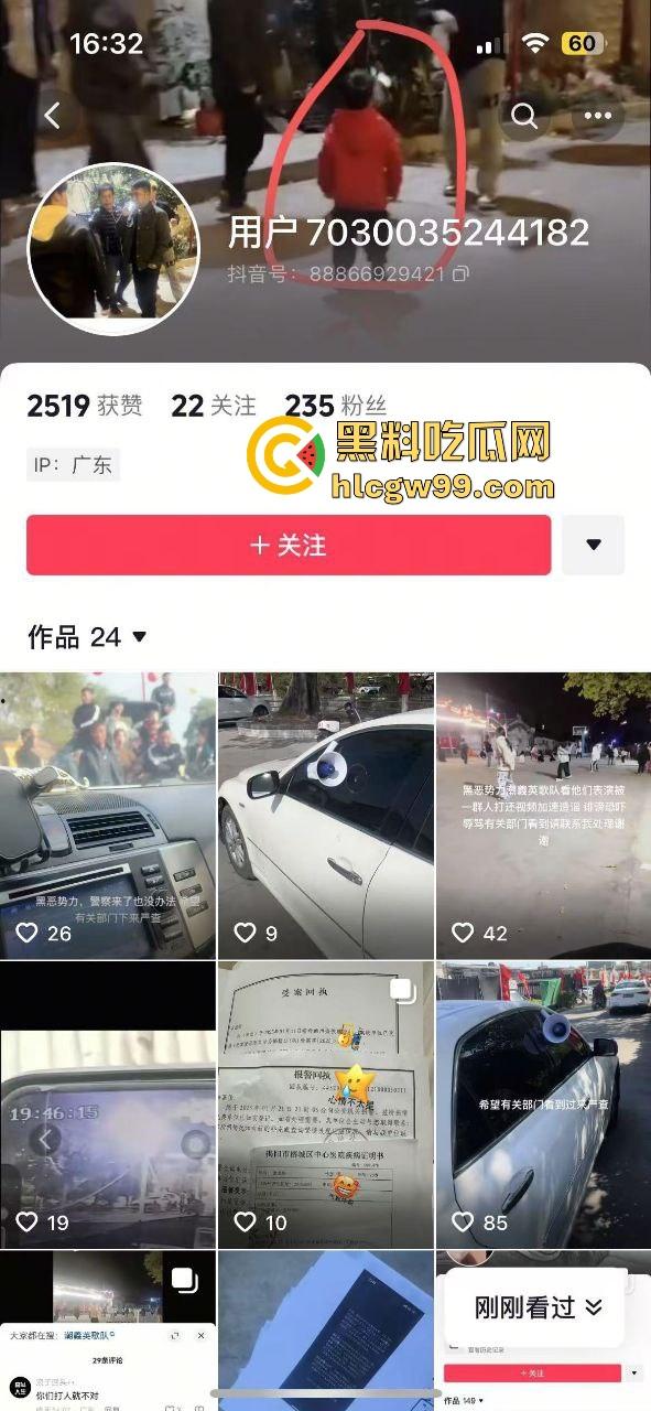 潮汕男子飙车狂言车300万撞死人保险赔，结果被英歌队打到脑震荡，现在出院嚷嚷黑势力又被围了！  第1张