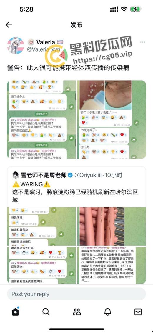 毁三观！逆天男娘在哈尔滨投毒被举报 性病晚期浑身流脓还准备卖塞进过自己直肠的烤肠创业 被热心群友举报进局子  第4张