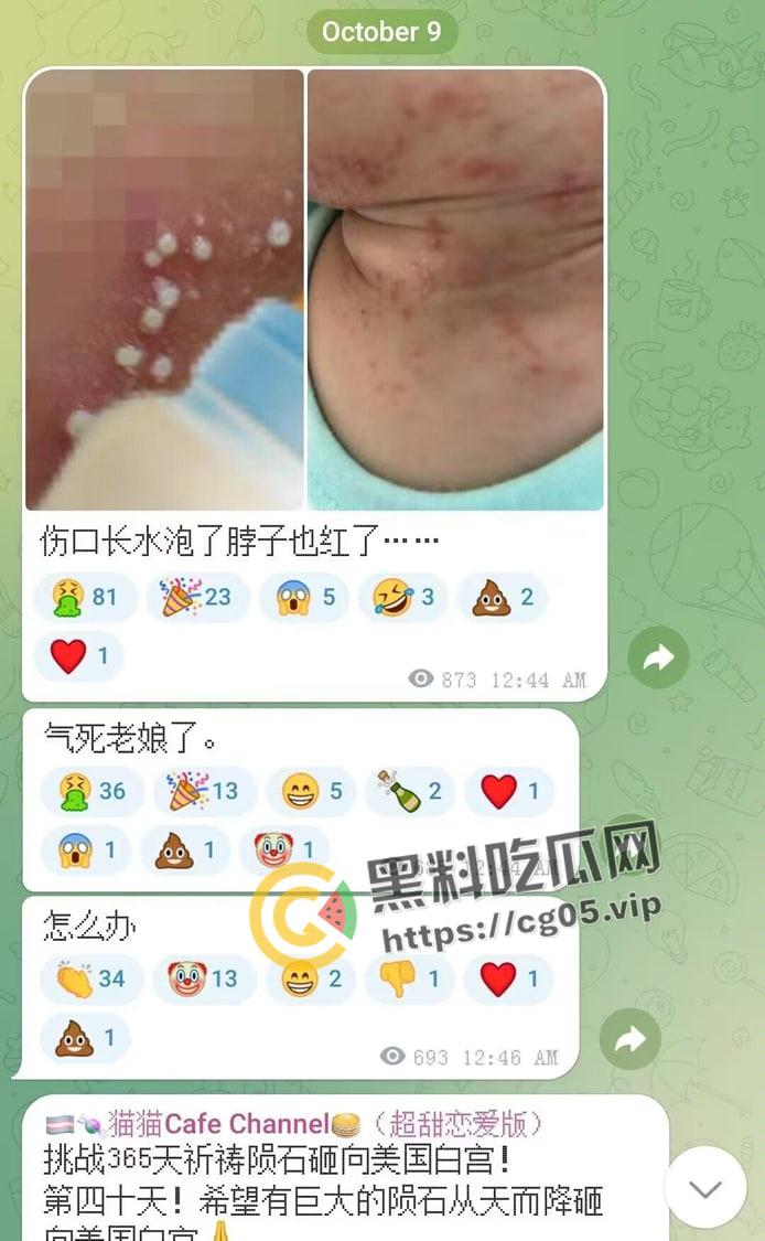 毁三观！逆天男娘在哈尔滨投毒被举报 性病晚期浑身流脓还准备卖塞进过自己直肠的烤肠创业 被热心群友举报进局子  第10张