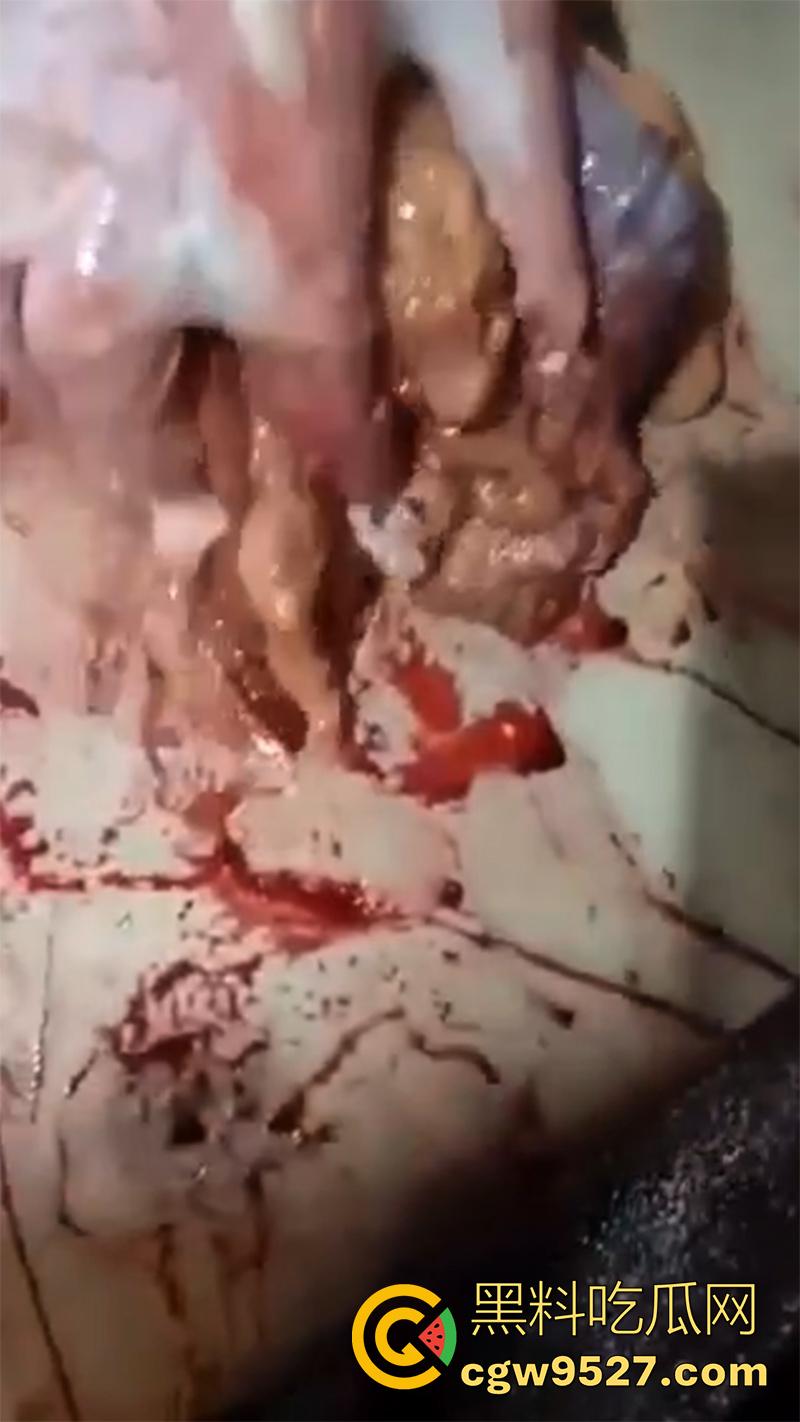 暗网流出血腥合集，吃人腿爆头剥皮车祸，想要的应有尽有，场面血腥过于重口，胆小者谨慎观看！  第3张