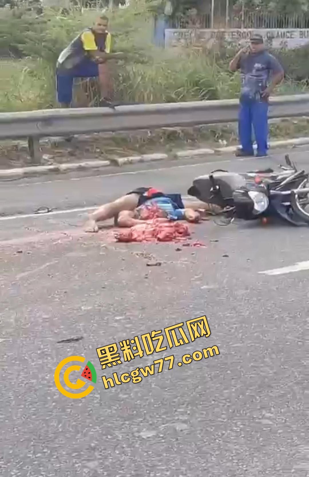 巴西若昂佩索阿摩托车手脸撕裂头断身碎！血腥车祸脸直接撕裂开，路人还想上去捡肾脏！  第5张