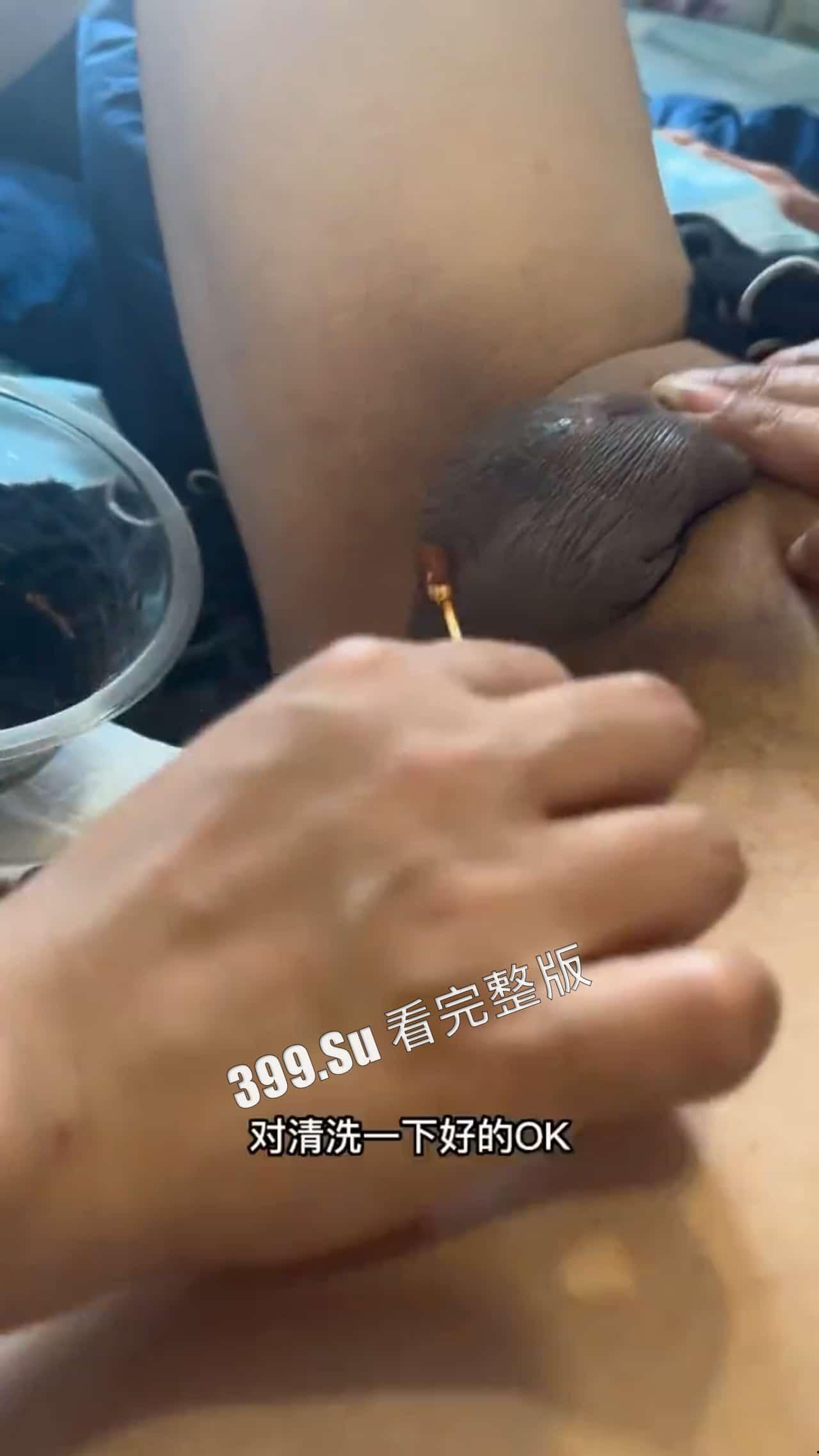 变性手术  术后实录 做女人啦！不过阴道真的有感觉嘛~瓜友们怎么看？ 第1张