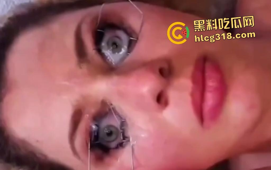 外国女子用开眼器撑眼皮，被男友撸管射精进眼睛，精子灌满双眼，这是开天眼了吧？  第3张