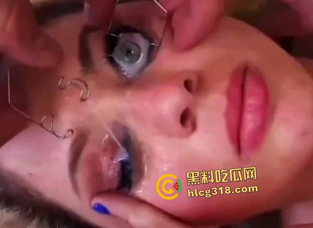 外国女子用开眼器撑眼皮，被男友撸管射精进眼睛，精子灌满双眼，这是开天眼了吧？  第7张