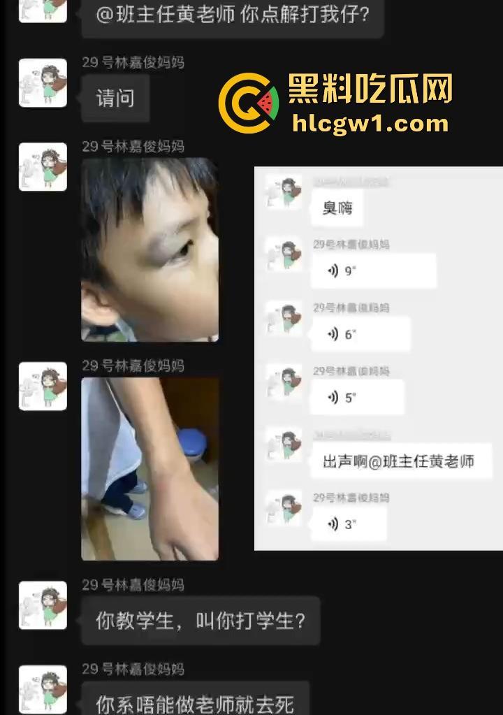 广州金隆小学曝惊天丑闻！初中学生遭体罚虐待，遍体鳞伤，家长被辱骂怒火中烧！  第10张