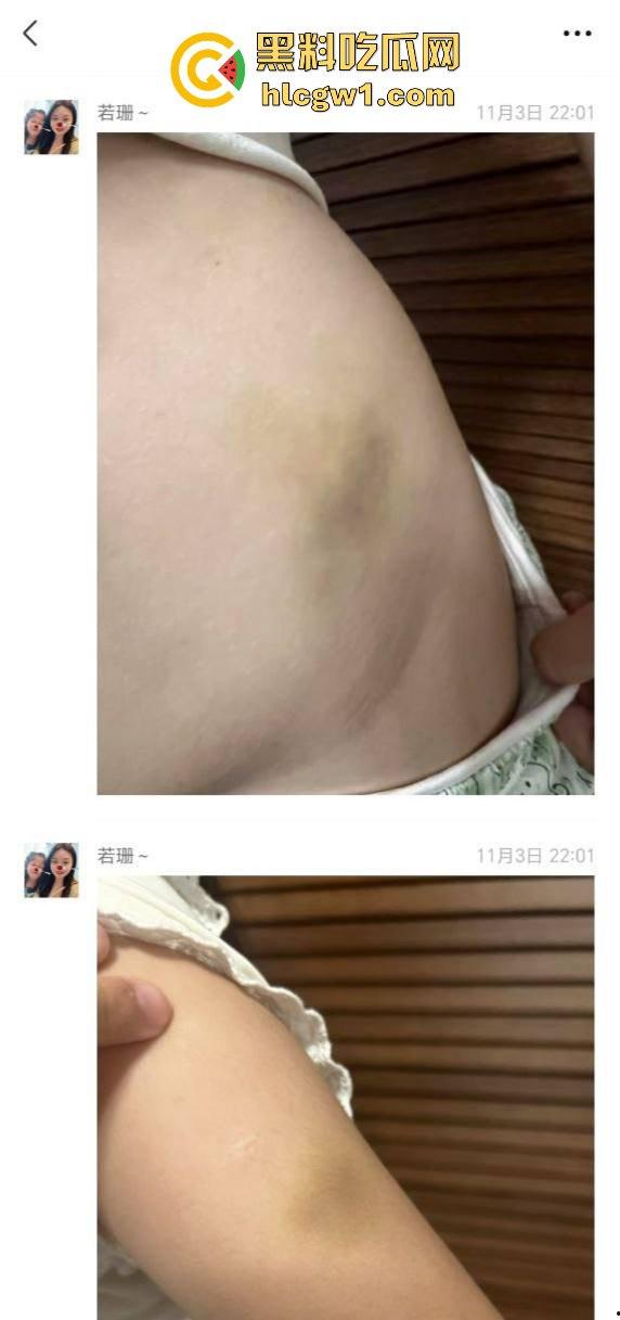 广州金隆小学曝惊天丑闻！初中学生遭体罚虐待，遍体鳞伤，家长被辱骂怒火中烧！  第11张