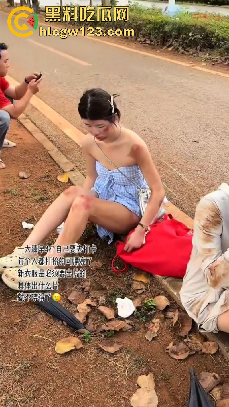 一生要强的中国女人，就算出车祸一身伤，也是必须要出片，不管摔成什么样拍照才是第一位！  第2张