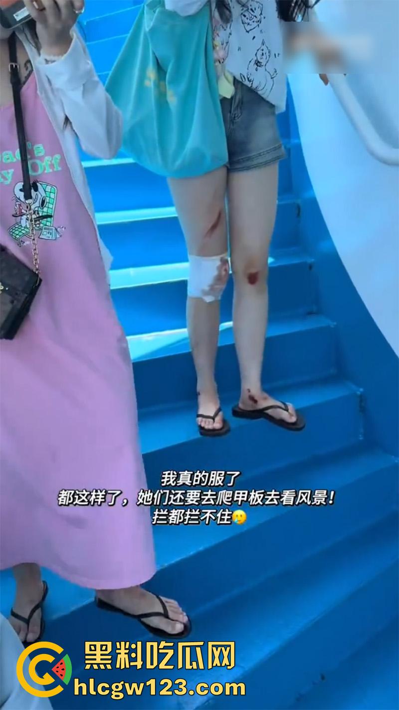 一生要强的中国女人，就算出车祸一身伤，也是必须要出片，不管摔成什么样拍照才是第一位！  第7张