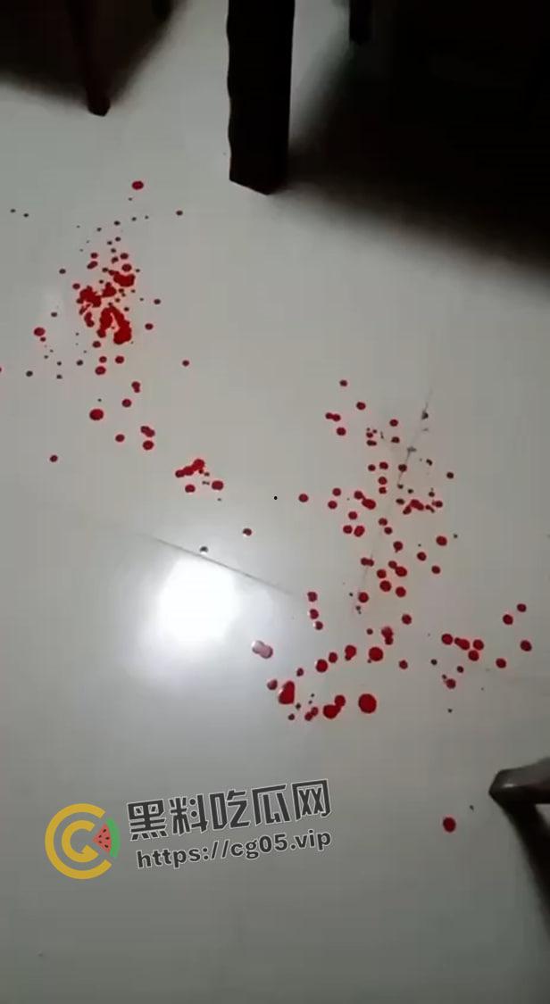 四川蓬安女子遭入户抢劫 微信里只有七百块也被抢走了 还说敢报警杀全家 现场遍地鲜血  第3张