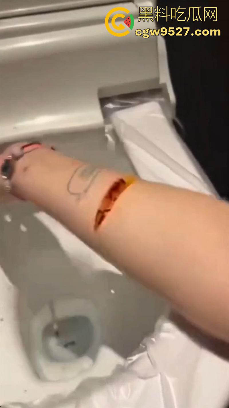 全网疯传马桶割腕女孩，真实自杀鸡皮疙瘩都起来了，脂肪层都割开了，还扒拉了一下，太重口了！  第4张