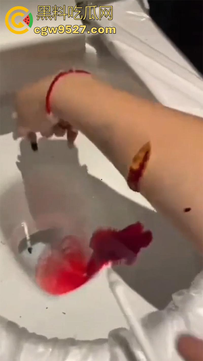 全网疯传马桶割腕女孩，真实自杀鸡皮疙瘩都起来了，脂肪层都割开了，还扒拉了一下，太重口了！  第5张