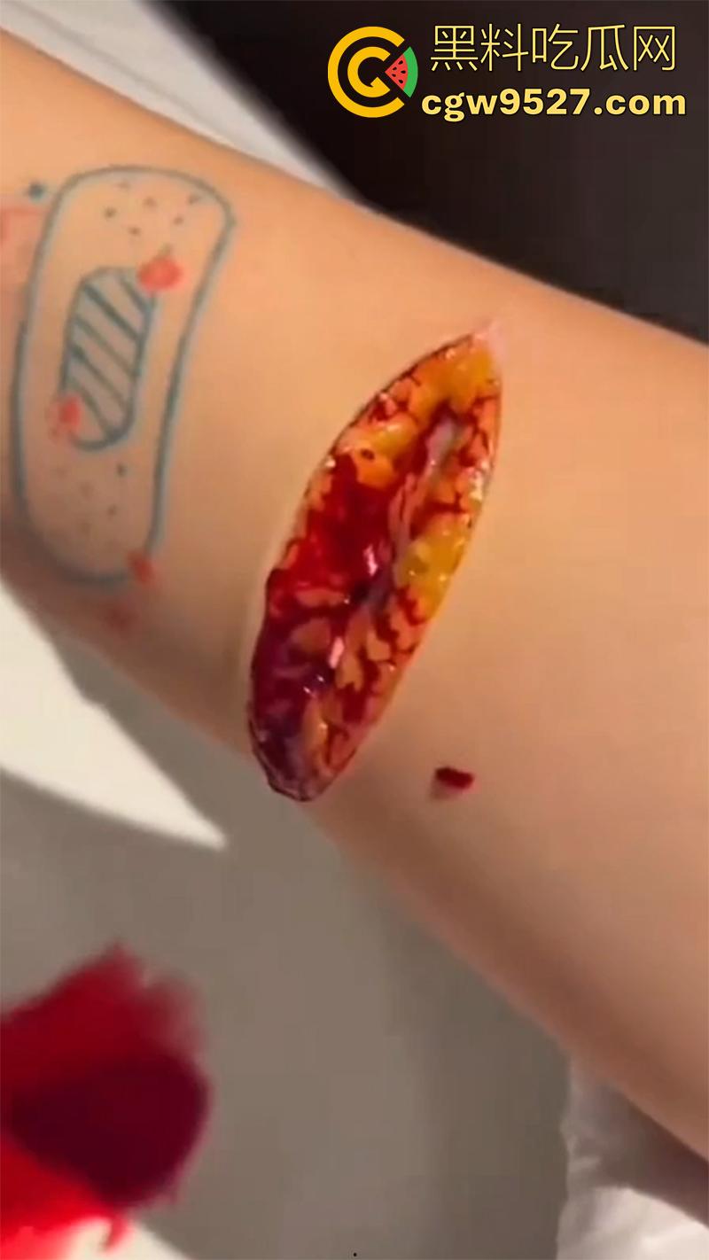 全网疯传马桶割腕女孩，真实自杀鸡皮疙瘩都起来了，脂肪层都割开了，还扒拉了一下，太重口了！  第6张