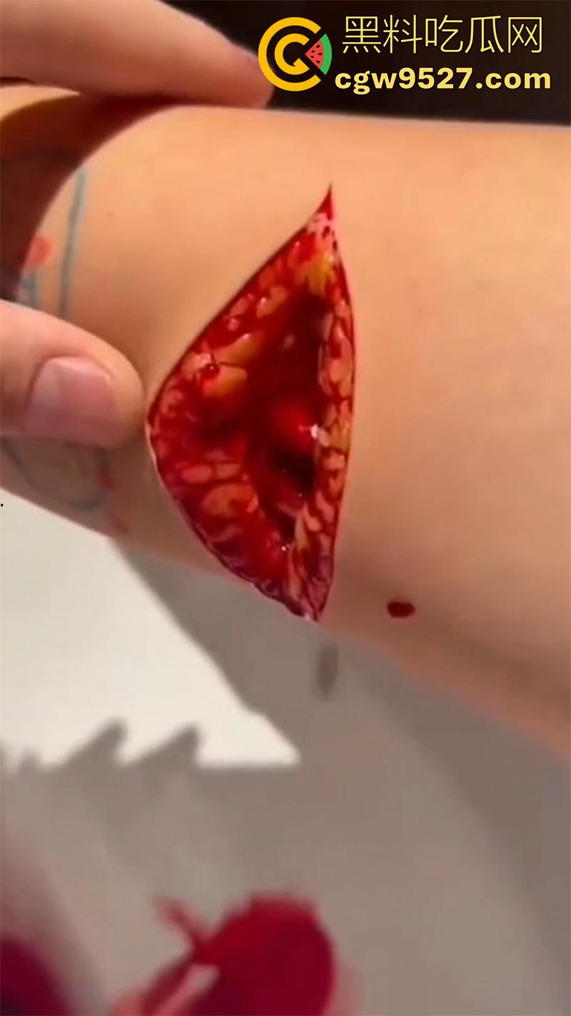 全网疯传马桶割腕女孩，真实自杀鸡皮疙瘩都起来了，脂肪层都割开了，还扒拉了一下，太重口了！  第7张