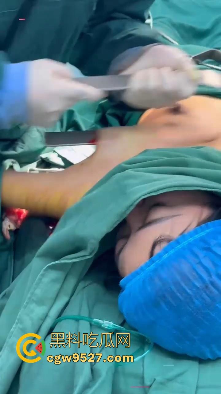 隆胸整形手术现场大曝光！平乳妹秒变巨乳御姐，手术过程一览无遗，女人为变美的代价真大！  第1张