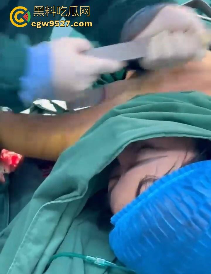 隆胸整形手术现场大曝光！平乳妹秒变巨乳御姐，手术过程一览无遗，女人为变美的代价真大！  第2张
