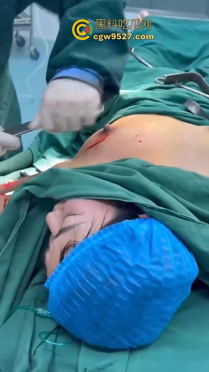 隆胸整形手术现场大曝光！平乳妹秒变巨乳御姐，手术过程一览无遗，女人为变美的代价真大！  第4张