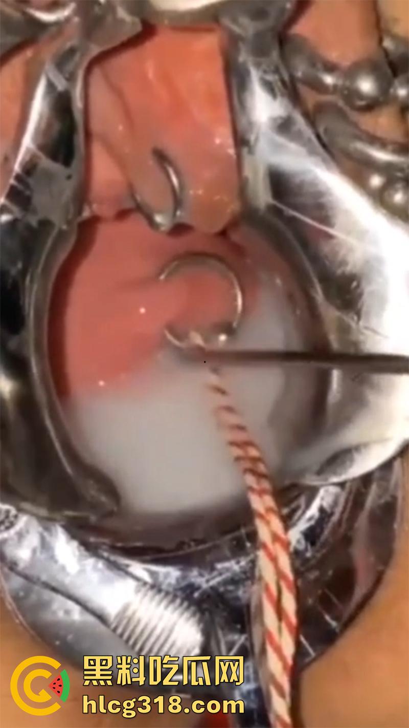 重口极限引导扩张虐穴，逼里塞图钉钢管插子宫口，鸡巴爆插尿道操的骚逼白浆四溢，宫颈真像个鱼唇！  第8张