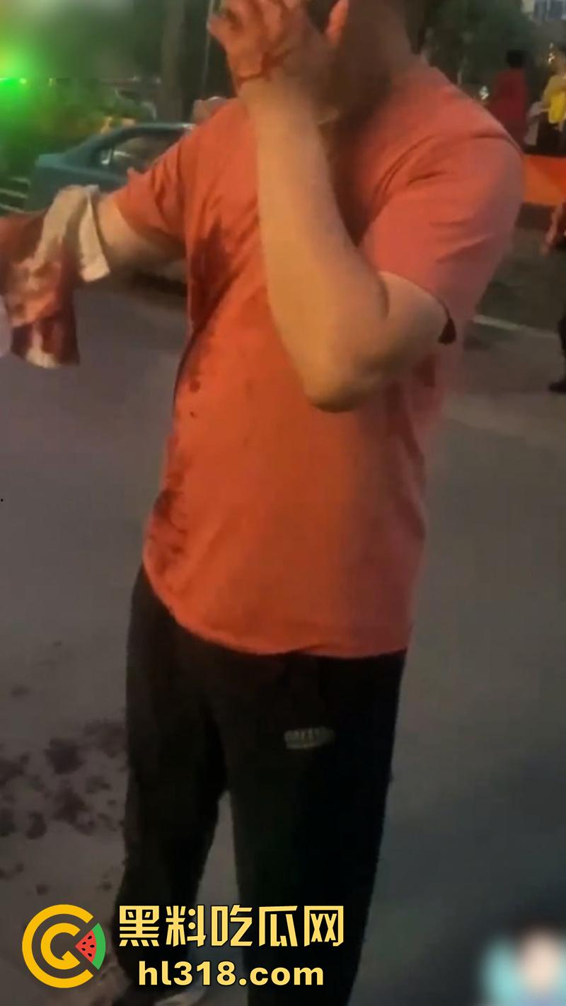 秦皇岛红桥里砍人事件，持刀报复社会在大街上见人就砍，据说有20多人被砍，目前人已被逮捕！  第1张