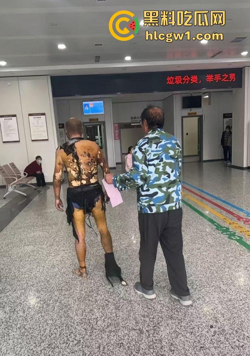 江苏常州易化工厂油罐爆炸 现场员工大面积烧伤 场面骇人 现场视频曝光皮都烧掉了  第10张