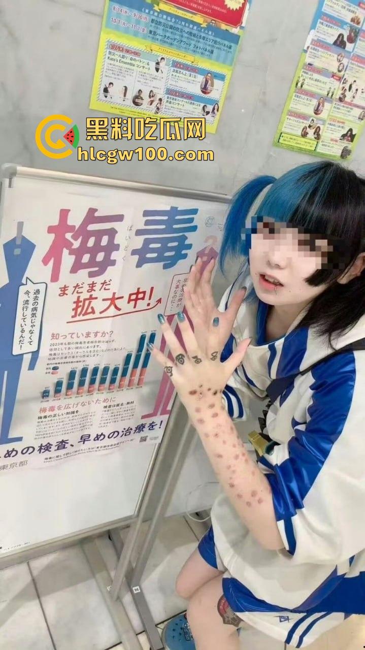 日本性病感染激增背后的文化畸形 性产业的泛滥让健康危机全面爆发 性病被当成时尚让性病成社会毒瘤！  第8张